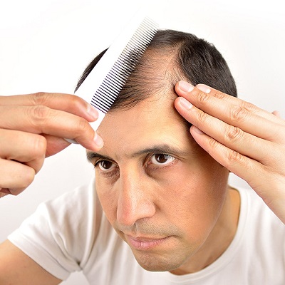 علاج تساقط الشعر دبي
