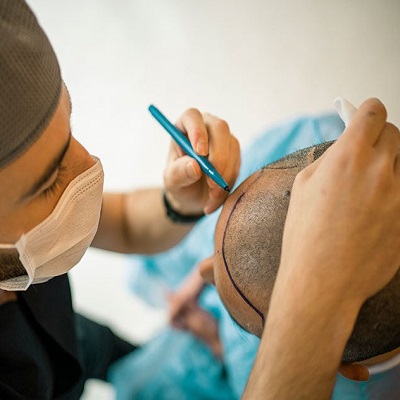 Hair Transplant In Dubai For 1 Dirham